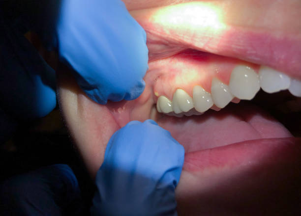 Best After-Hours Dental Trauma Care in Rosanky, TX